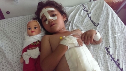 Shaymaa_al-Masri,_five_years_old,_at_a-Shifaa_Hospital,_Gaza._Shaymaa_was_injured_when_her_uncle’s_house_was_bombed_in_the_early_afternoon_of_9_July_2014
