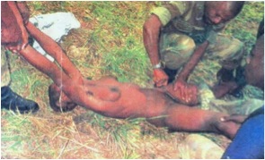 Femme mutilée en République Démocratique du Congo par des soldats. 