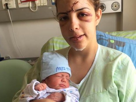 Einav Zebulon, la jeune maman, blessée lors d'un carambolage