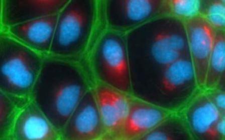 Université de Tel Aviv, UHJ : des cellules du foie humaines développées en laboratoire